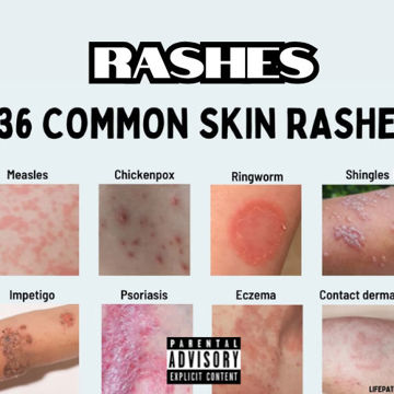Rashes by crater | BandLab